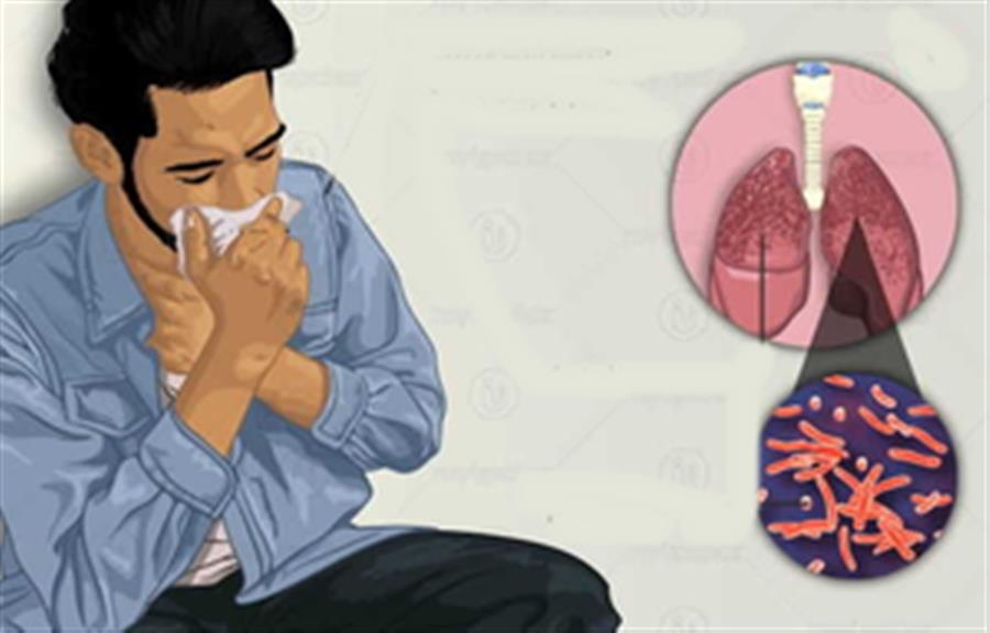 TB diagnosis must go beyond persistent cough: Lancet study